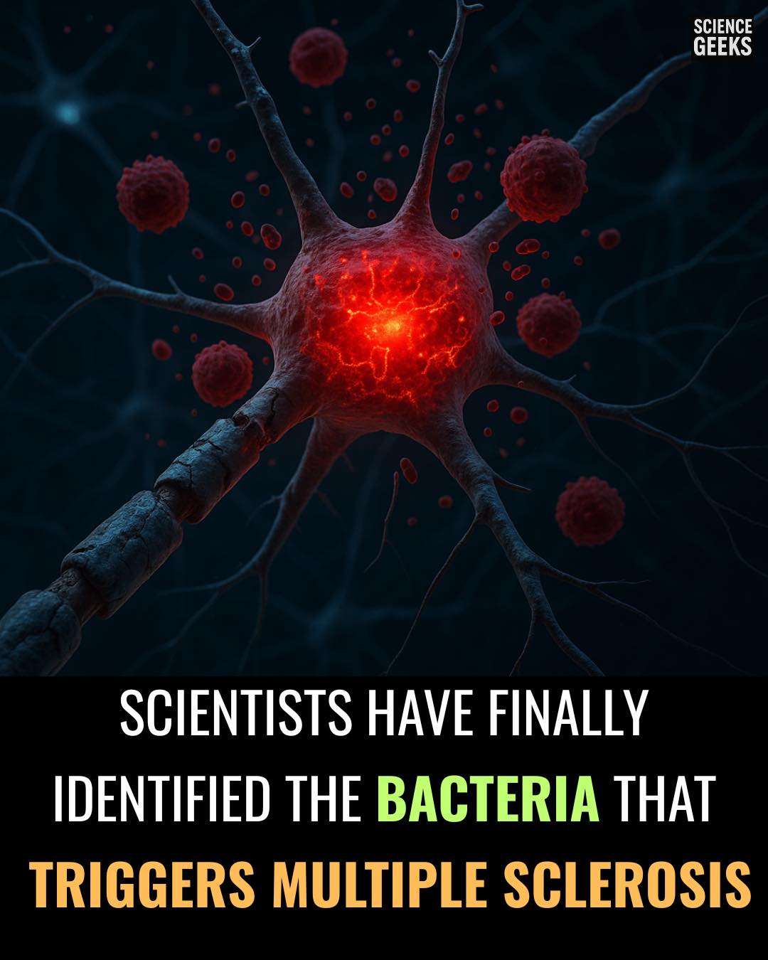 Neurologie: le ventre, la flore intestinale et les intestins sont notre ...